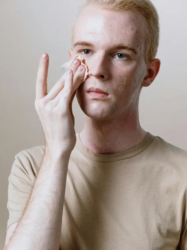 6 Kebiasaan Sepele yang Memicu Kerutan Muncul Lebih Cepat, Jangan Dibiasakan!