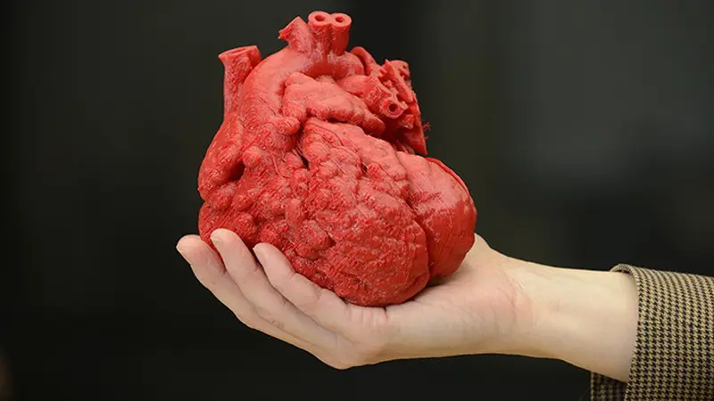 Printer 3D Selamatkan Bayi Dari Penyakit Jantung