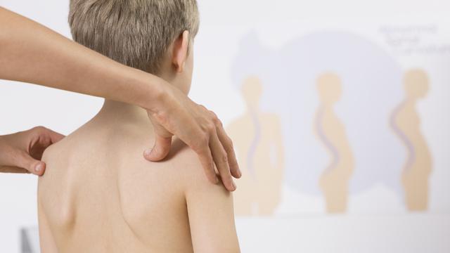 Penyakit Aneh dan Langka di Dunia