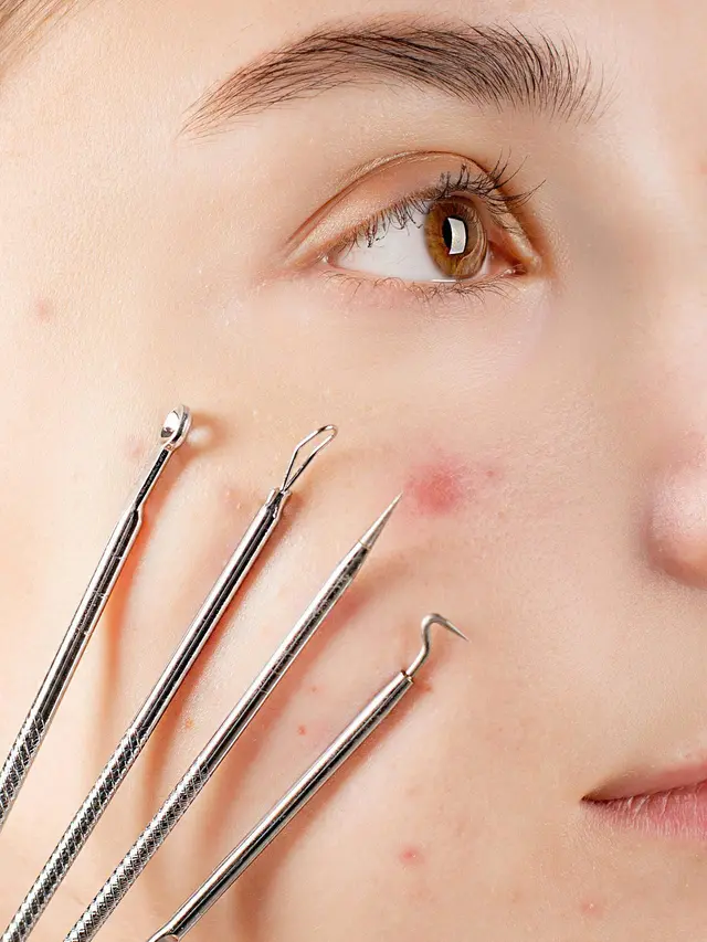 Kandungan Skincare untuk Komedo: Kenali Perawatan yang Tepat Demi Wajah Mulus Tanpa Drama