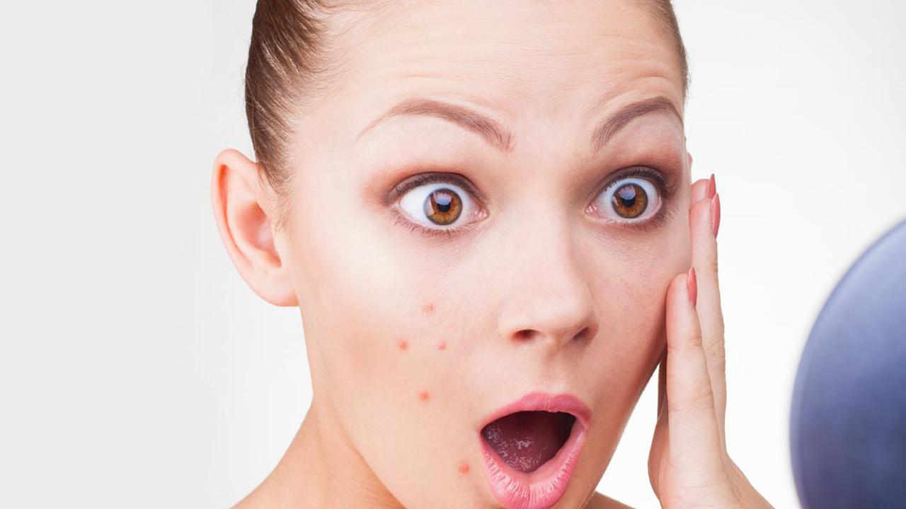 Kebanyakan Makan Telur Ternyata Tak Sebabkan Bisul