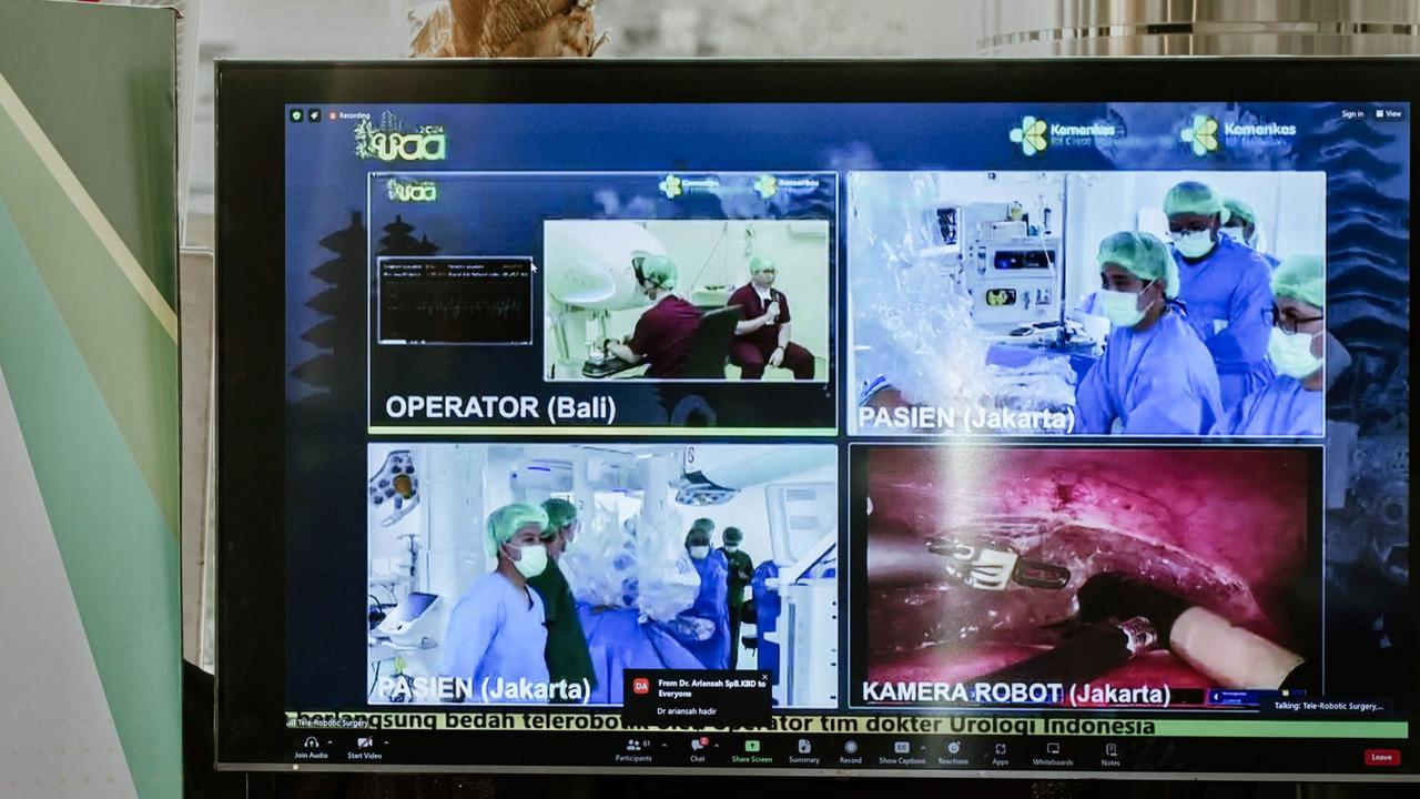 Operasi Jarak Jauh Mulai Dilakukan di Indonesia, Dokter di Bali dan Pasien di Jakarta