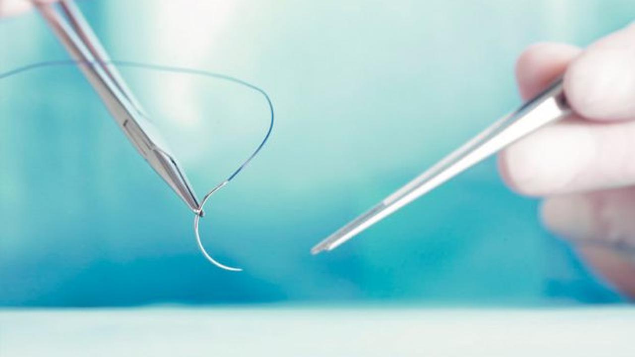 Benang Jahit Luka (Sumber: Padham Health News)