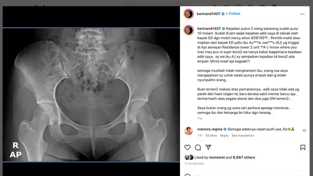 Unggahan Bertrand Antolin. (Foto: Dok. Instagram @bertrand1407)