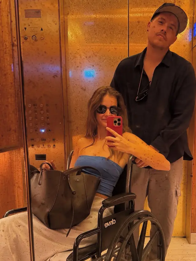 Endometriosis yang Terjadi pada Perempuan seperti Barbara Palvin. [@realbarbarapalvin]