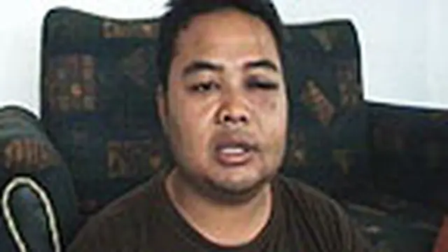 Korban Salah Tangkap Babak Belur Dipukuli Polisi