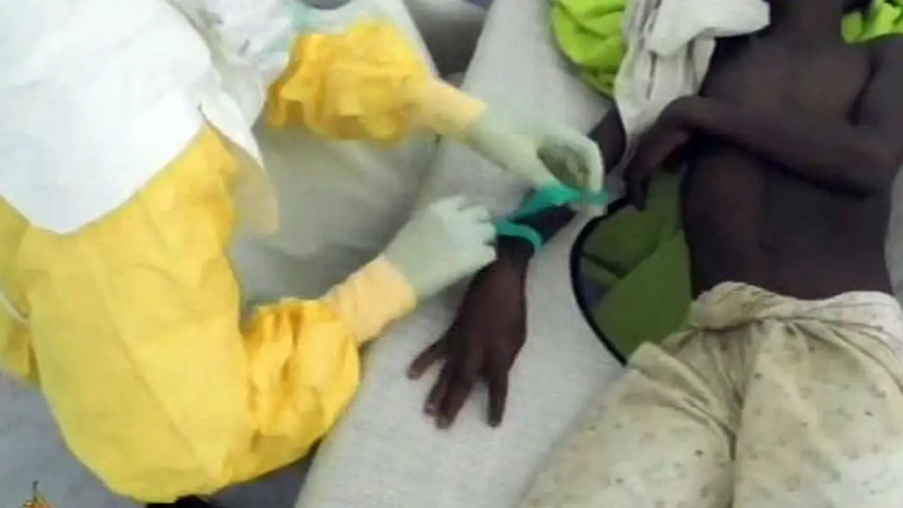 Klinik-Ebola