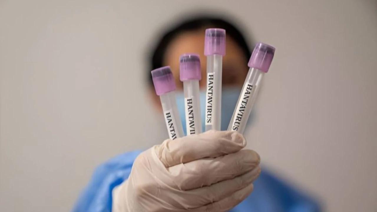 Empat Kasus Hantavirus Ditemukan di Jakarta, Begini Kondisi Pasien