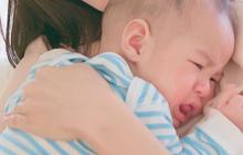 Masalah Kesehatan Kulit yang Paling Rentan Dialami oleh Bayi dan Anak