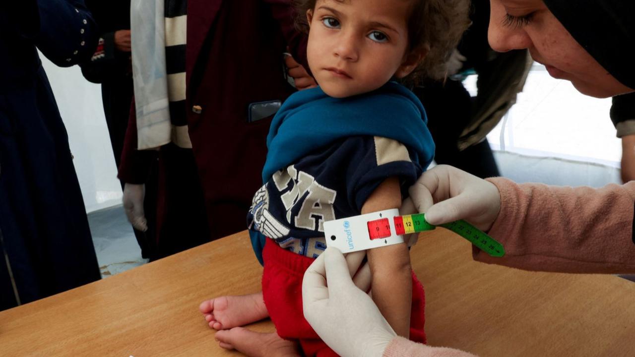 Anak-anak Palestina di kamp pengungsian Rafah, Gaza selatan sedang menghadapi masalah serius yaitu kekurangan gizi. Kondisi ini sangat memprihatinkan dan perlu mendapatkan perhatian. Foto: REUTERS / Ibraheem Abu Mustafa
