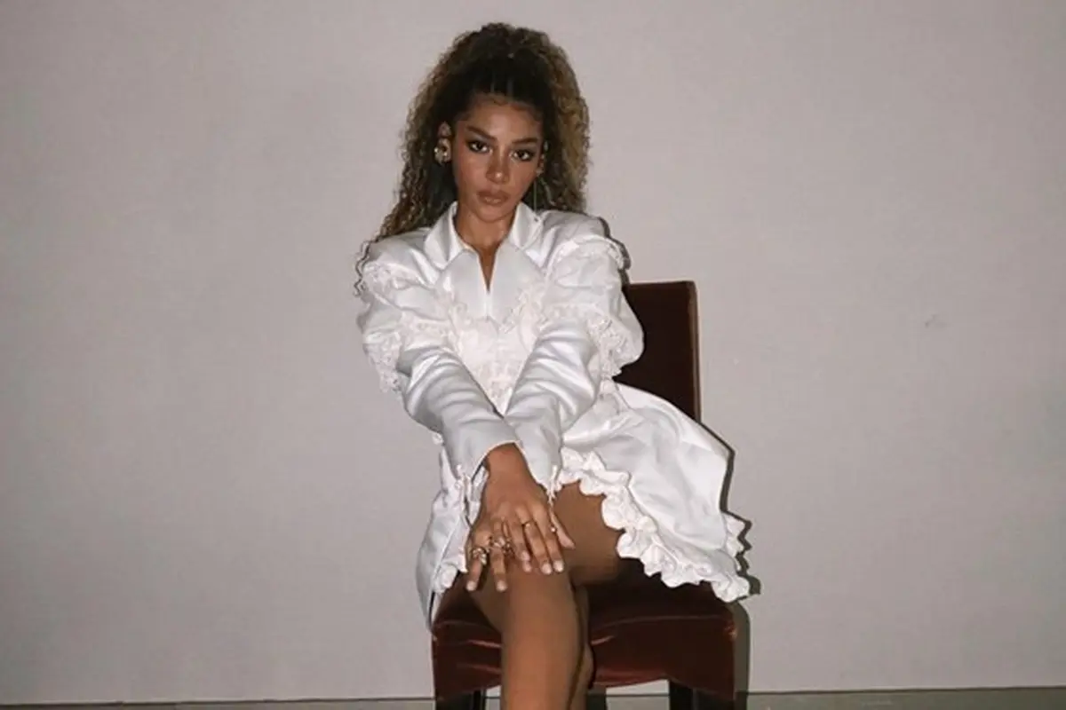 7 Potret Terbaru Zsa Zsa Si Cemong yang Diduga Operasi Plastik, Disebut Mirip Beyonce