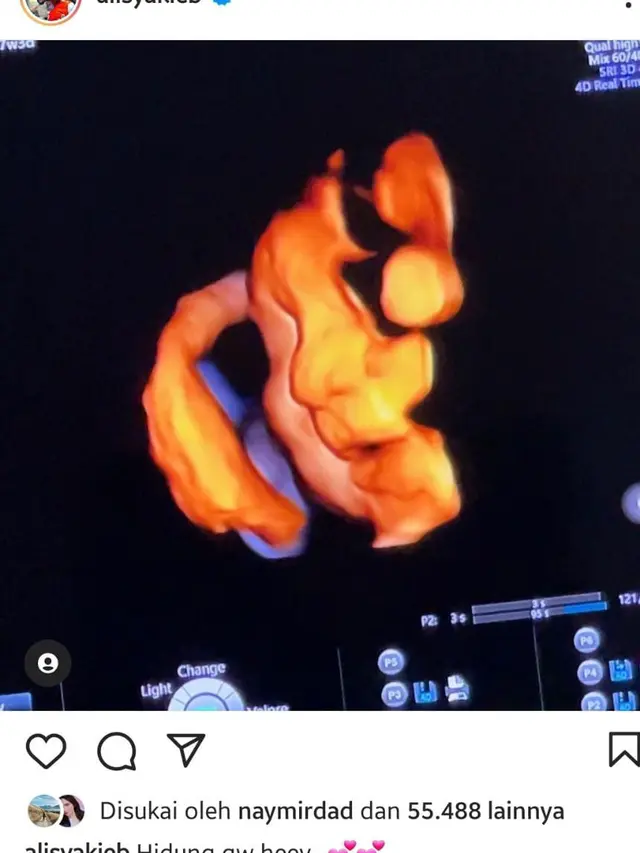 Calon Anak Ali Syakieb
