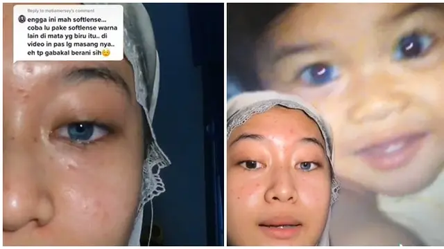 Sering Dikira Pakai Lensa Kontak, Warna Iris Mata Wanita Ini Curi Perhatian