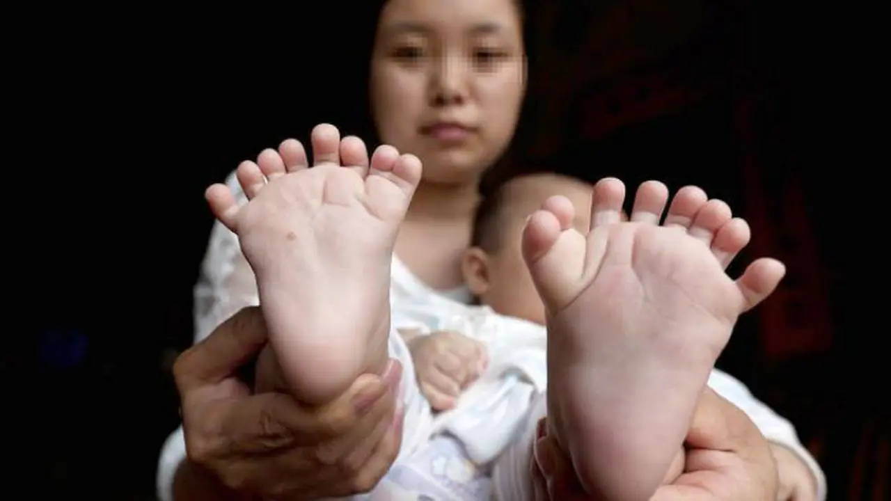 Bayi Berjari 31 di China Ini Butuh Uluran Tangan