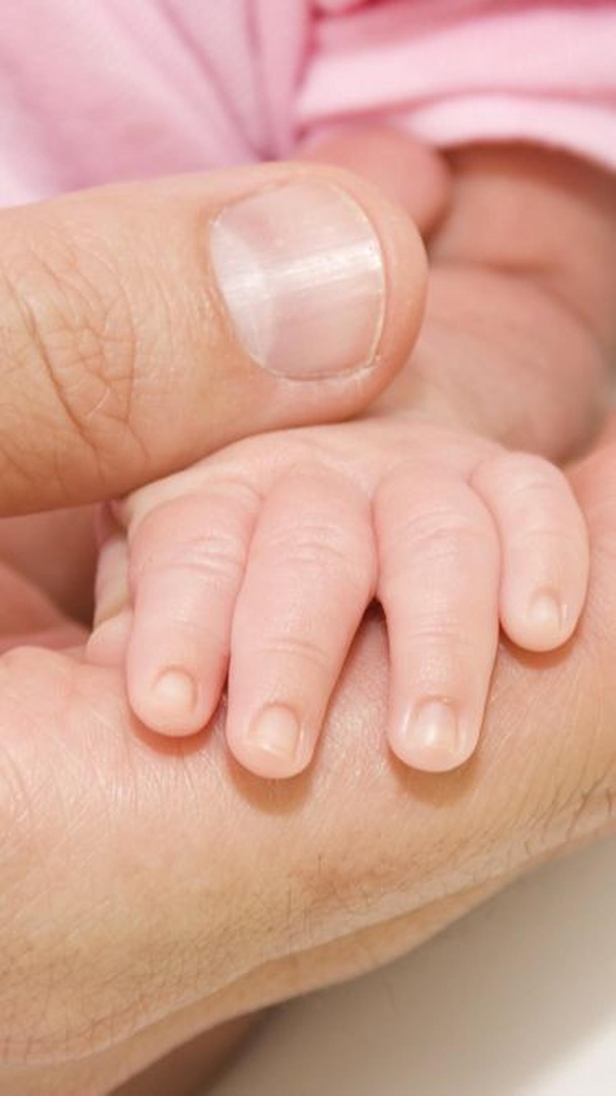 "Tetapi kehilangan seorang bayi atau memiliki bayi yang terluka dalam keadaan khusus ini adalah sesuatu yang tidak dapat dibayangkan," ujar mereka.