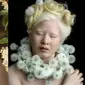 Dibuang ke Panti Asuhan Karena Albino, Ini 6 Potret Xueli Kini Sukses Jadi Model. (Sumber: Instagram/xueli_a)