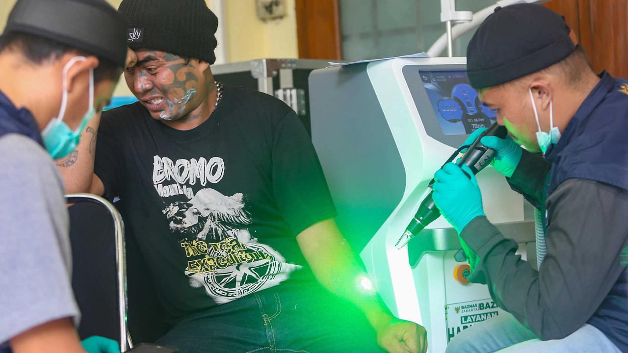 FOTO: Layanan Hapus Tato Gratis Sambut Ramadhan di Jakarta