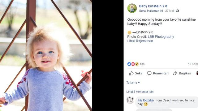 Bayi Lucu Ini Punya Rambut Jabrik Mirip Albert Einstein Health Liputan6 Com