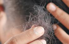 Berapakah Normalnya Rambut Rontok yang Boleh Ada di Kamar Mandi?