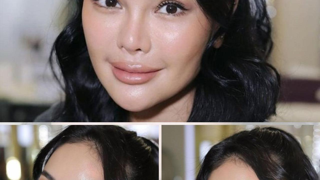 Oplas di Korea, Inilah 8 Potret Wajah Baru Nikita Mirzani - Makin Cantik Bikin Pangling
