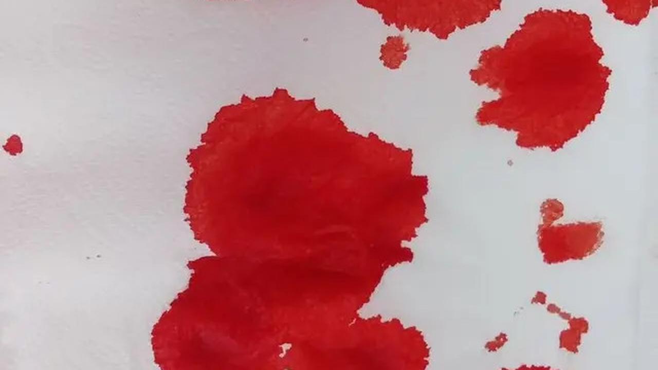 Cara Tepat Merawat Anak dengan Hemofilia agar Tetap Sehat dan Aktif