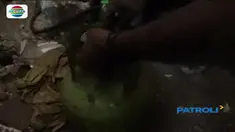 Seorang wanita menderita luka bakar sebanyak 30 persen ketika memasak singkong.