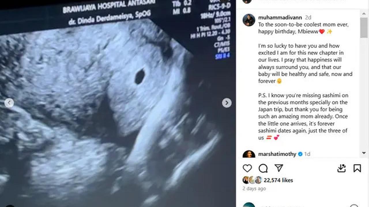 Putrinya Lagi Hamil, Tora Sudiro Bakal Jadi Kakek