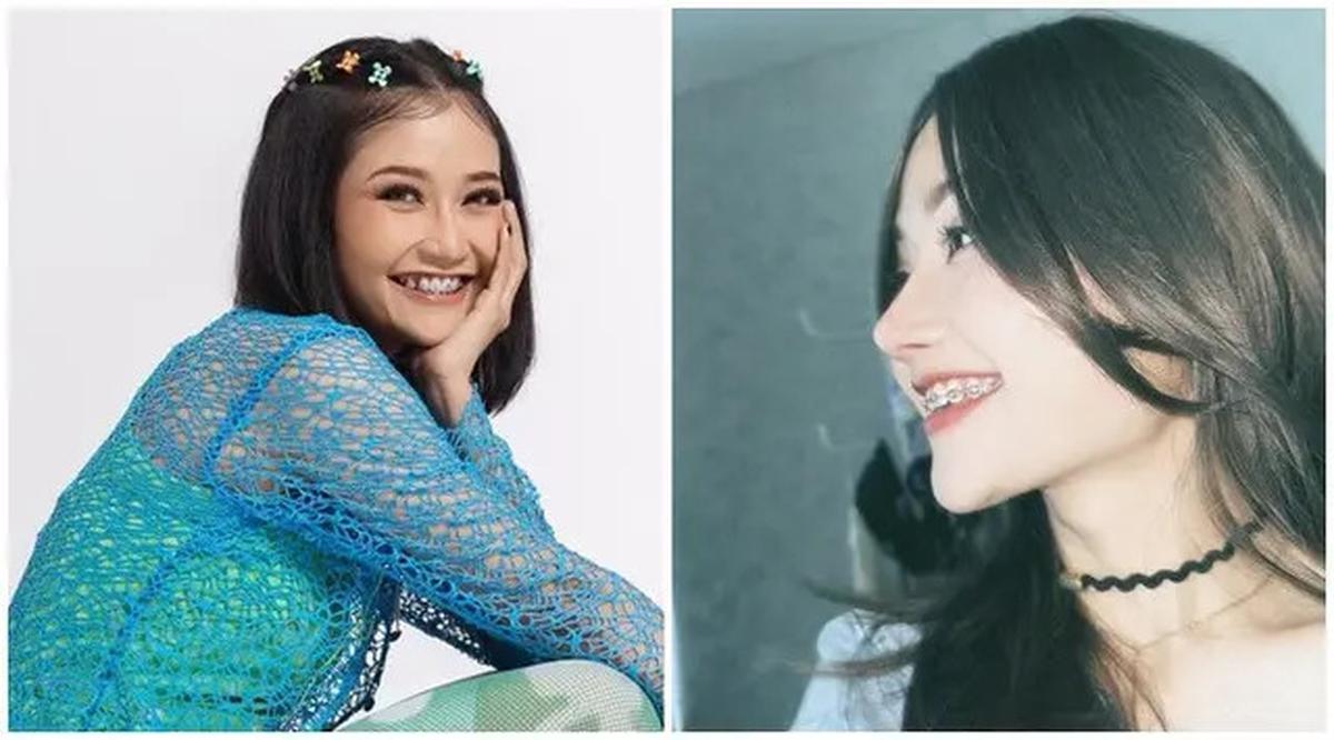 6 Potret Riyuka Bunga Sebelum dan Sesudah Oplas Hidung, Dulu Dipanggil Pesek