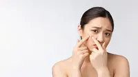 How to Remove Whiteheads at Home: 9 Simple Tips to Try