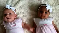 Kedua bayi ini sama-sama menggemaskan, siapa sangka mereka kembar. (Foto: The Sun)