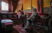 FOTO: Menanti Kaki Palsu di Tengah Luka Perang Gaza