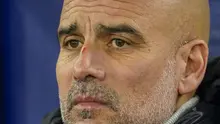 Manajer Man City, Pep Guardiola, terlihat mengalami luka goresan di hidungnya ketika berdiri di sisi lapangan menemani timnya bertanding melawan Feyenoord pada lanjutan Liga Champions 2024/2025 di Etihad Stadium, Rabu (27/11/2024) dini hari WIB. (AP Photo/Dave Thompson)