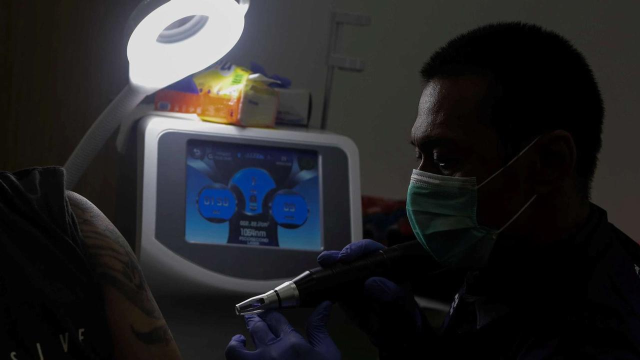 Layanan Hapus Tato Gratis di Jakarta