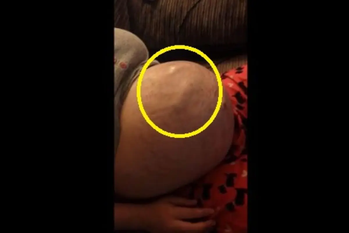 Jabang Bayi Tendang Perut Ibu, Kakinya Sampai Terlihat
