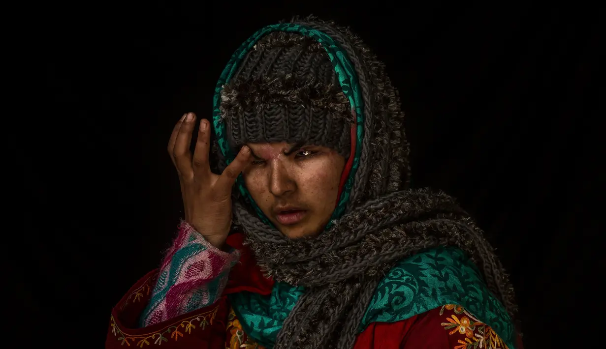 Pada 29 November 2016, Insya Mushtaq Malik berpose saat di foto di dalam rumahnya di Sedow selatan Kashmir. Hanya menyaksikan bentrokan di depan rumahnya tiba-tiba pengelihatan Insya menjadi gelap. (AP Photo / Bernat Armangue)