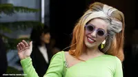 Lady Gaga: Ada Kawah Besar di Panggul Saya