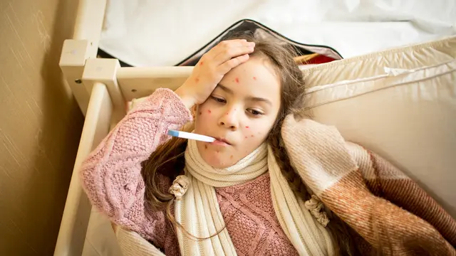 7 Cara Efektif Mengobati Cacar Air pada Anak Dengan Bahan Rumahan