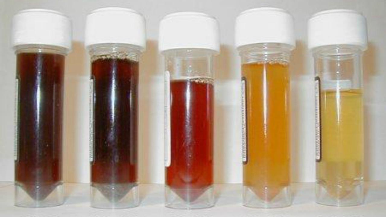 Warna urin dan tinja (1)