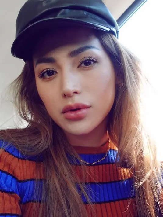 "Kaaaaann.. Jadi keterusan kak @inijedar Fillernyaa.. Bagusan idung aj kak yg di filler.. Bibir jgn.. Bagusan tipis kmaren2.. Duh sayang bgt," tulis salah satu akun. (Instagram/inijedar)