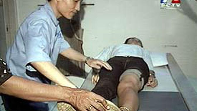 Tbc Tulang Dapat Menyebabkan Kekeroposan News Liputan6 Com