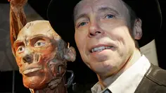 Gunther von Hagens Meninggal, Penemu Plastinasi Punya Wasiat Tak Lazim