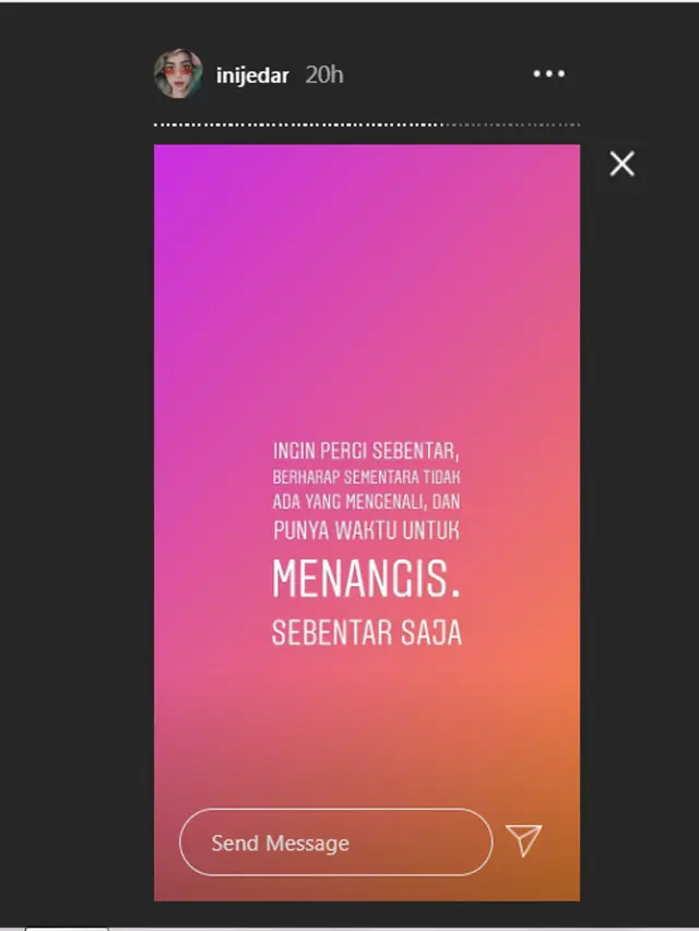 Jessica Iskandar merasa hidupnya tak berguna karena idap autoimun