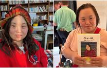 Sosok Jung Eun Hye, Aktris Korea Pengidap Down Syndrome yang Jadi Ikon Inspirasi Lewat Karya