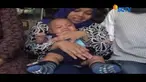 Bayi asal Pekalongan ini mengalami cacat pada hidung. Diduga menjadi korban malapraktik.