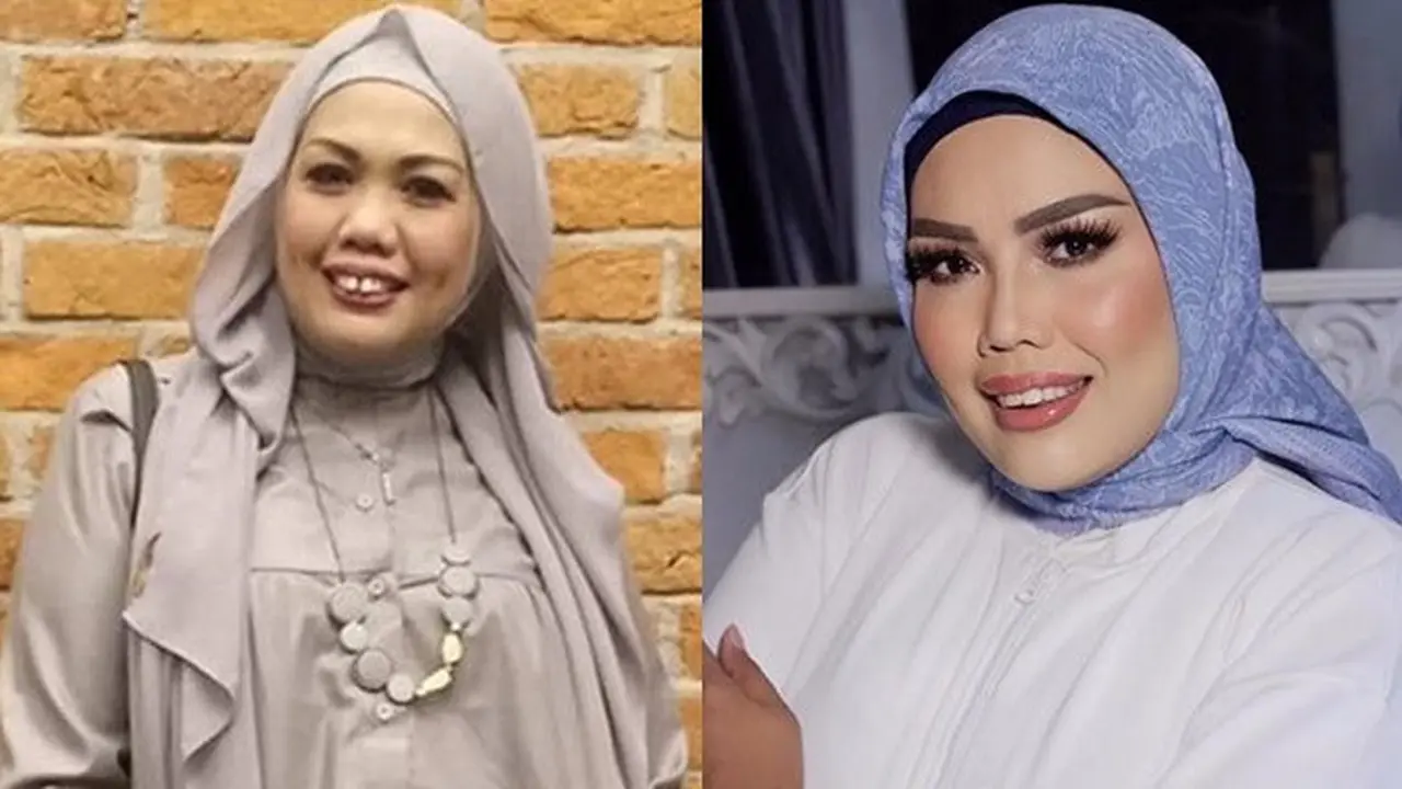 Akui Pakai Susuk, Ini 6 Potret Terbaru Elly Sugigi yang Kini Sudah Melepasnya