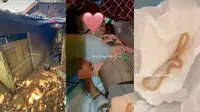Bocah Seluma Bengkulu Keluarkan Cacing dari Mulut, Kondisi Rumah Jadi Sorotan