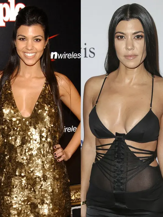 Kourtney Kardashian melakukan operasi untuk memperbesar bentuk payudaranya. (Rex/Shutterstock/HollywoodLife)