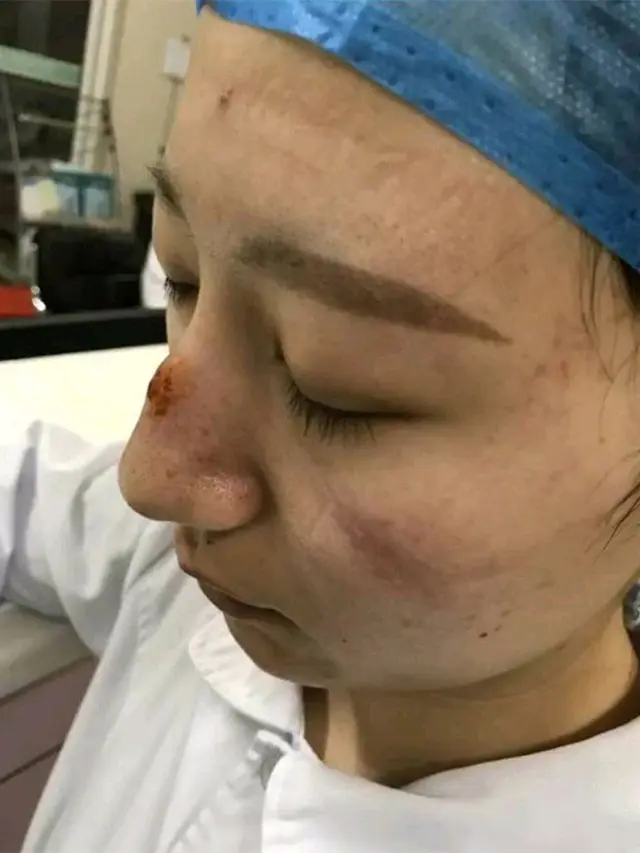 7 Potret Memilukan Tenaga Medis Kelelahan Bekerja Hadapi Pasien Virus Corona, Ini Pesan Mereka