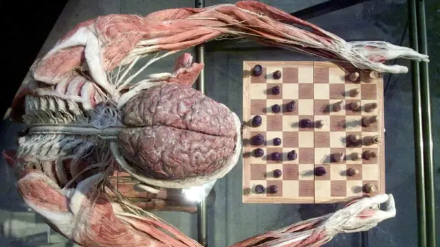 Gunther von Hagens
