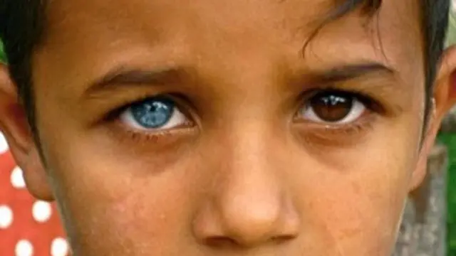 Chimerisme genetik/dok. © infoniac.ru